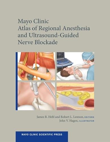Atlas d’anesthésie locorégionale et de blocs nerveux échoguidés de la Mayo Clinic