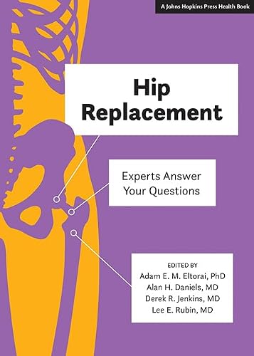 Remplacement de la hanche : les experts répondent à vos questions